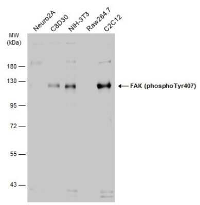 Western Blot: FAK [p Tyr407] Antibody [NBP3-13085]